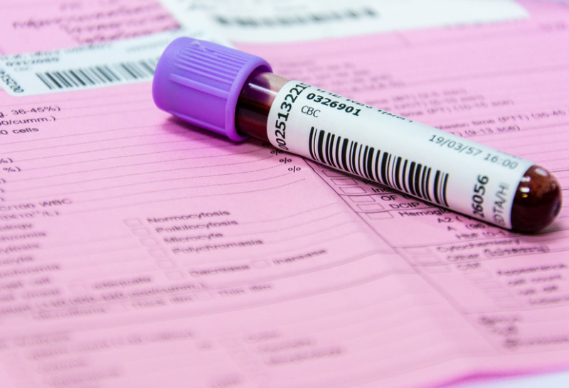 Blut- und Urinproben für ganzheitliche Gesundheitschecks im Labor